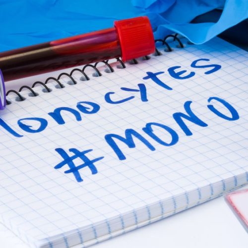 Monocyty – co to? Podwyższony poziom monocytów – dlaczego?