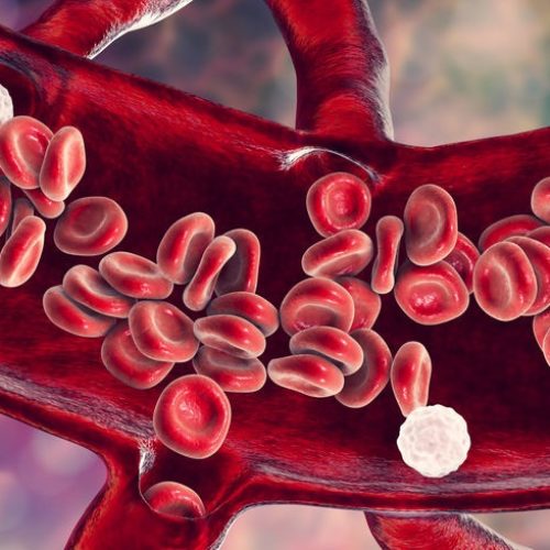 Leukocyty w moczu – Co to, jakie badania i jak leczyć?