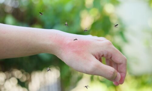 Dlaczego w ogóle komary gryzą, a bąbel swędzi?