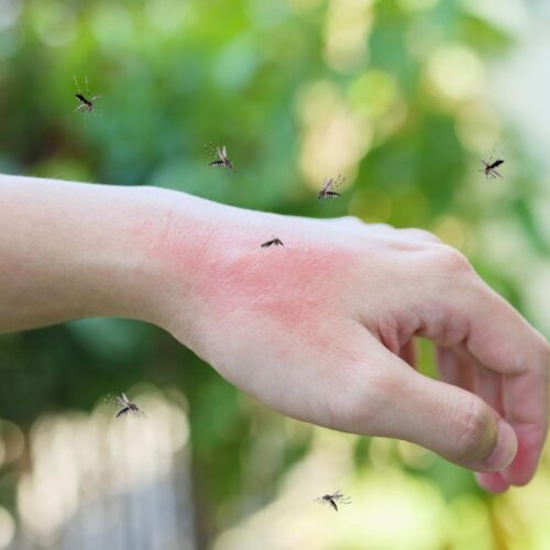 Dlaczego w ogóle komary gryzą, a bąbel swędzi?